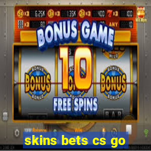 skins bets cs go