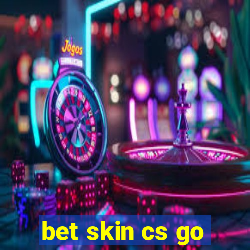 bet skin cs go