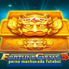 perna machucada futebol